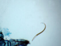 カゲロウの幼虫の寄生虫（100倍）の顕微鏡写真　フリー素材