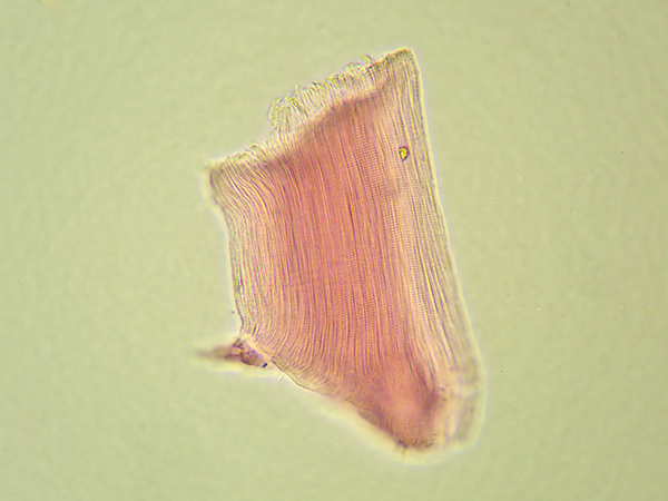 豚筋肉6 400倍 の顕微鏡写真 フリー素材 コトミルmicro