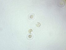 杉の花粉1（400倍）の顕微鏡写真　フリー素材